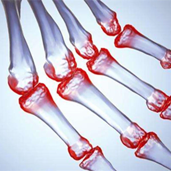 Piroxicam can treat rheumatic pain